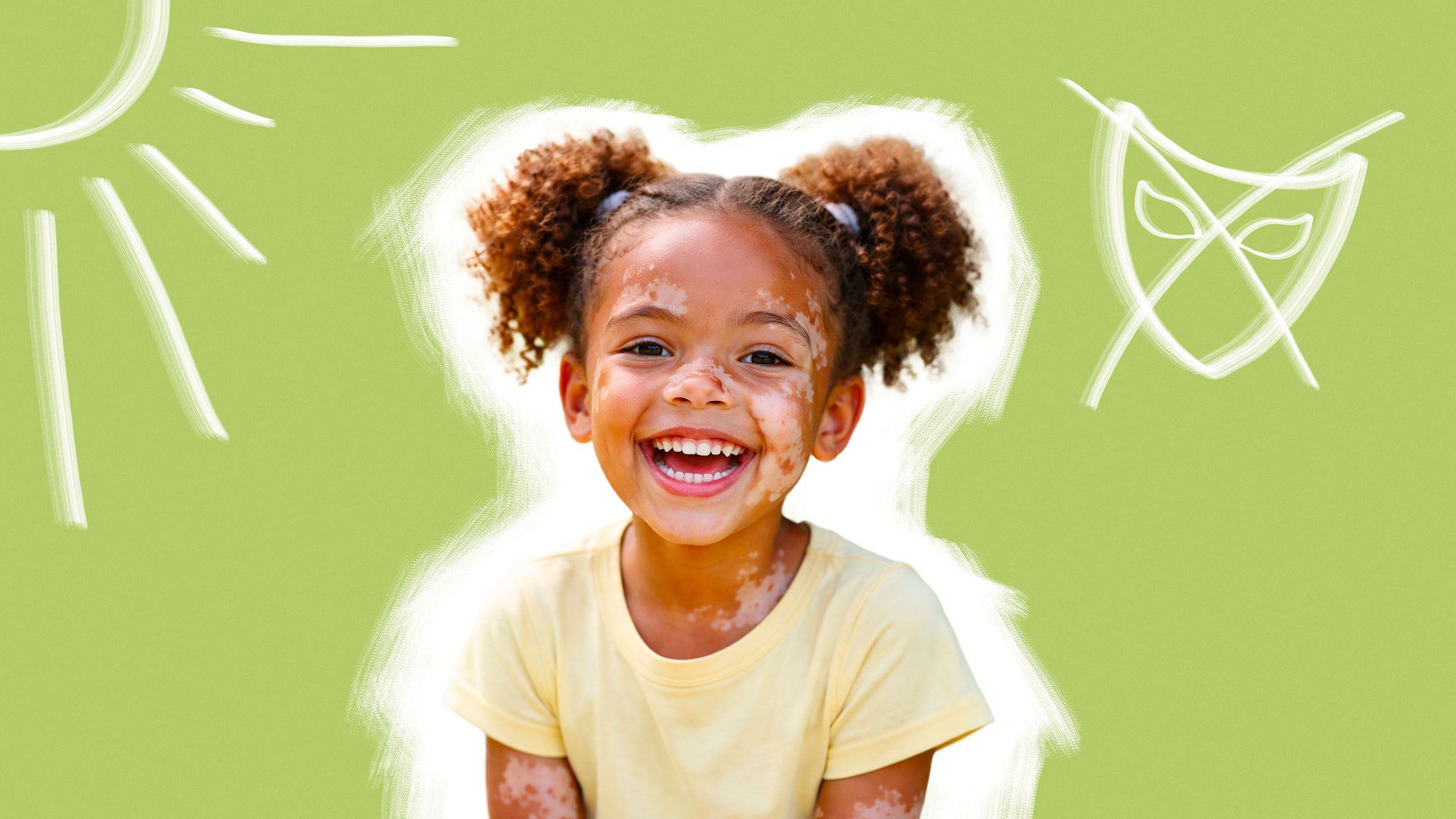 Витилиго у детей: жизнь без комплексов и дискомфорта